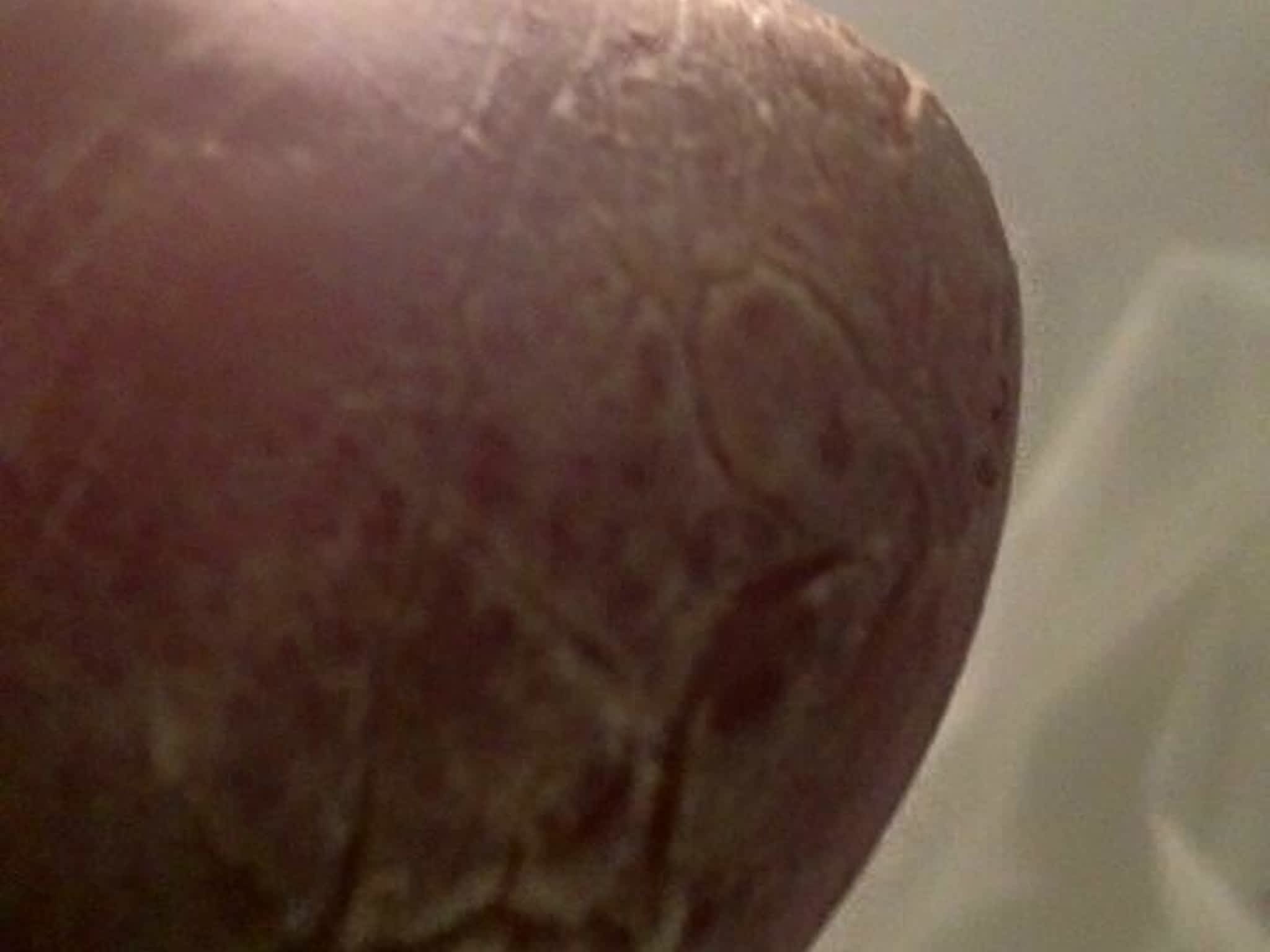 photo Technicienne en Soins nc