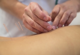 Get the point at these acupuncture clinics in Calgary