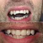 Dr Gurbaz Sandhu Dpc - Teeth Whitening Services