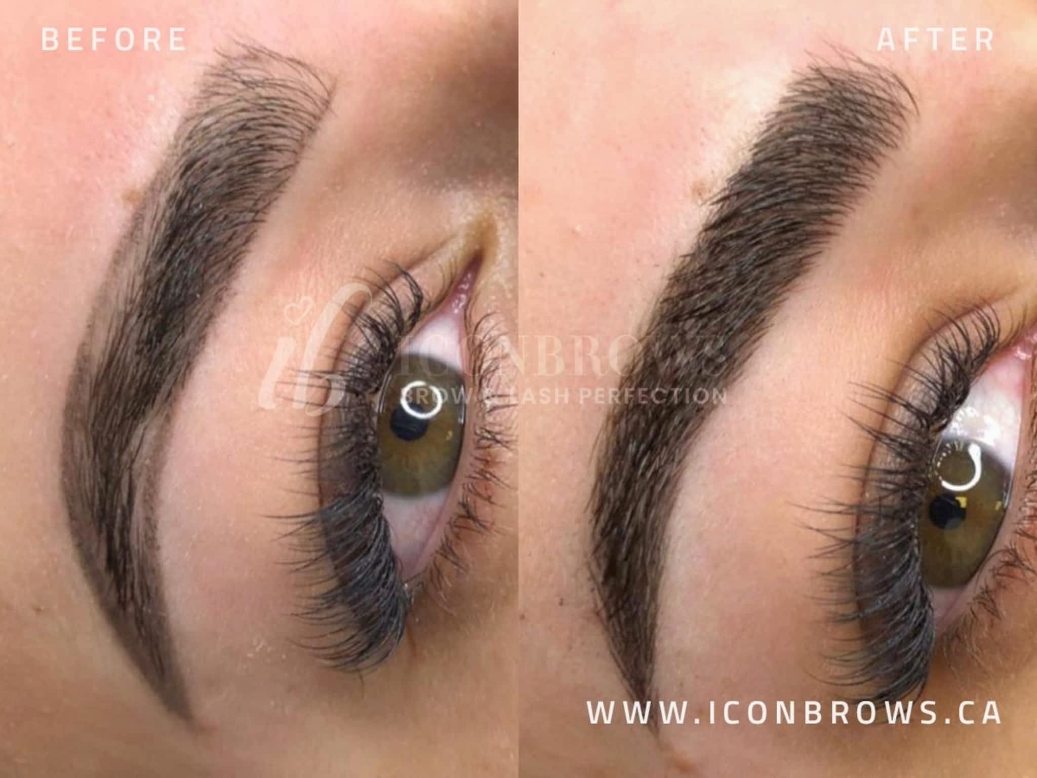 photo Iconbrows - Eyebrow Perfection | Professional Microblading