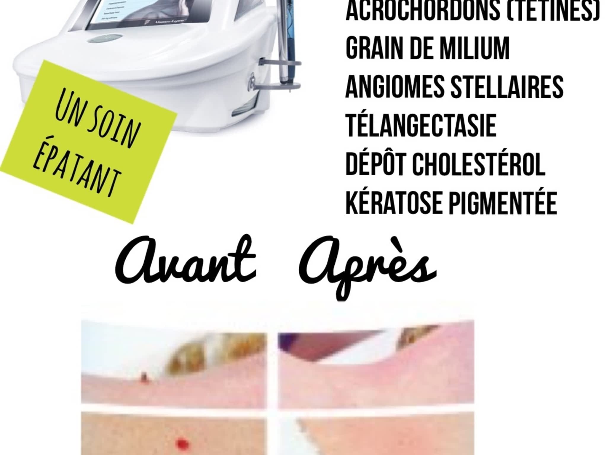 photo Esthétique Manon Bernier