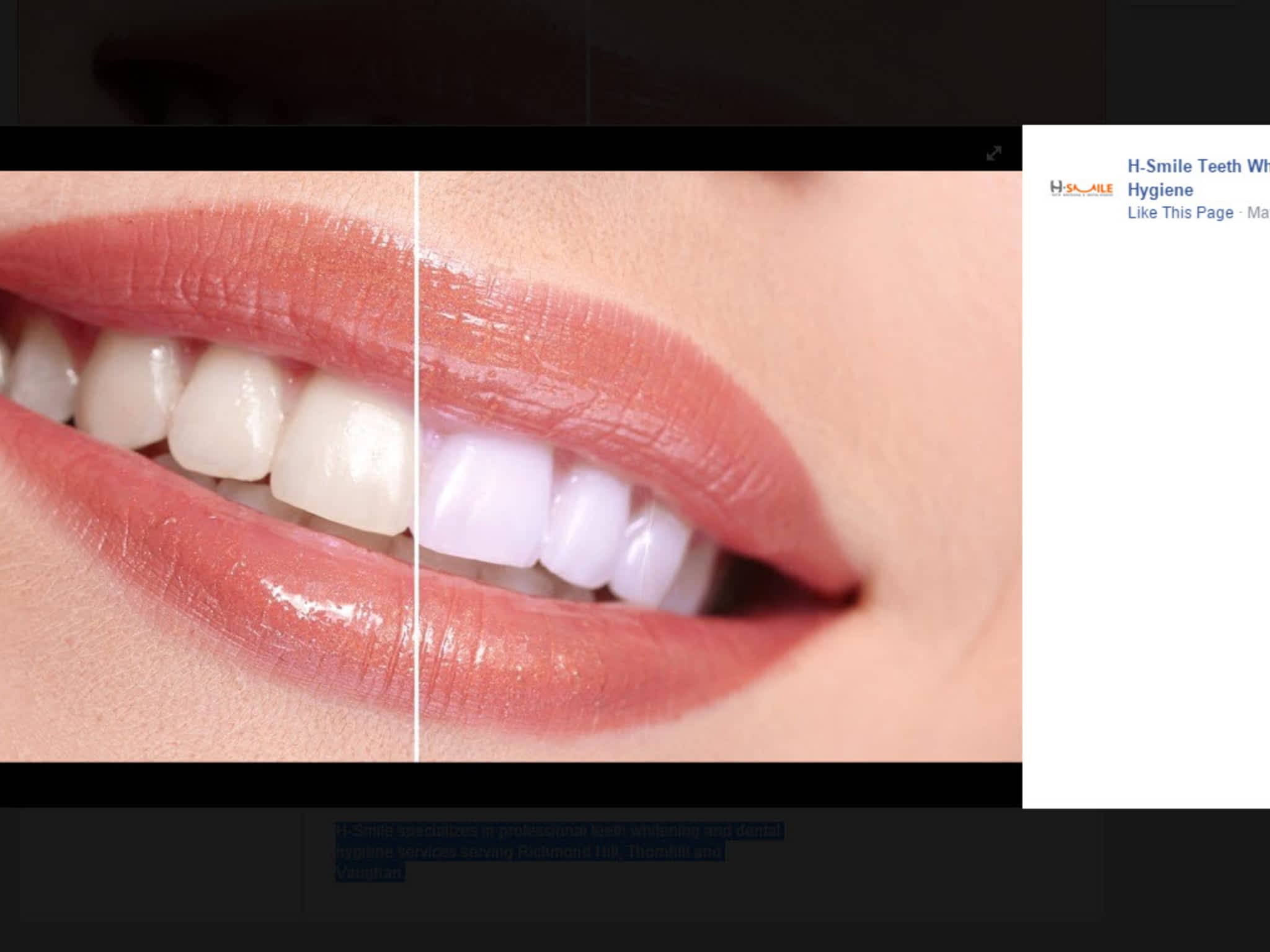 photo H-Smile Teeth Whitening and Dental Hygiene