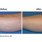 Touch of Elegance - Laser Hair Removal