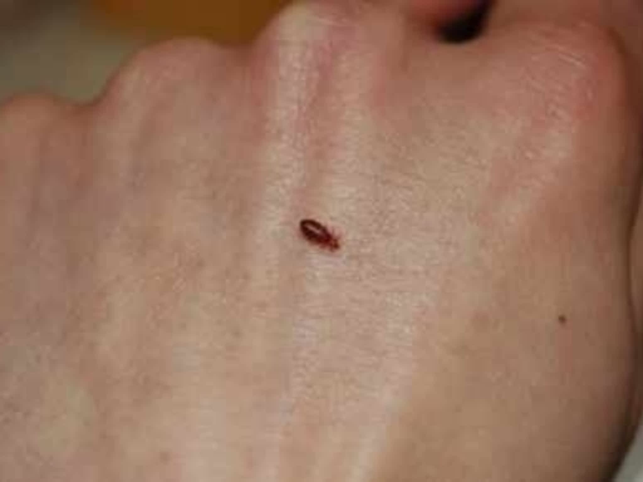 photo Solution Cimex