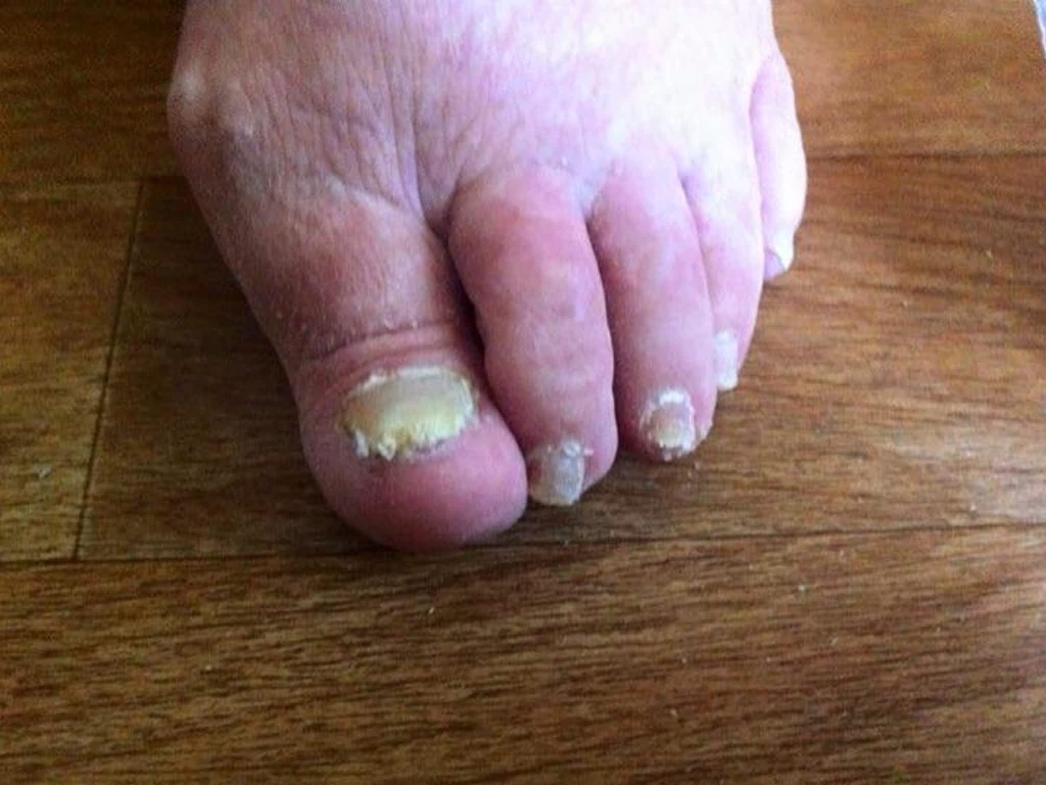 photo Technicienne en Soins nc