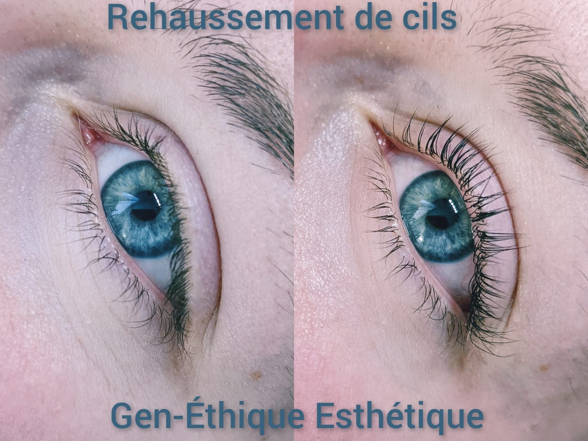 photo Gen-Éthique Esthétique