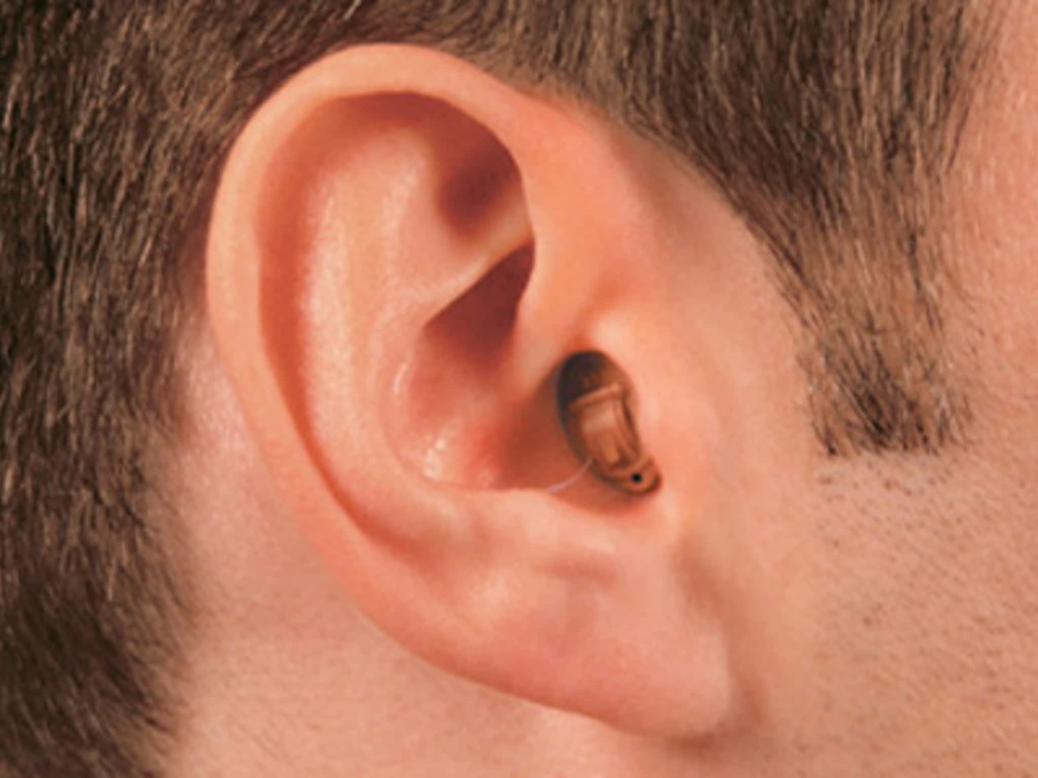 Слуховые аппараты бывают. Внутриушной слуховой аппарат virto b30 312. Внутриканальные слуховые аппараты Phonak. Внутриушной слуховой аппарат Phonak. Внутриканальный слуховой аппарат Phonak virto.