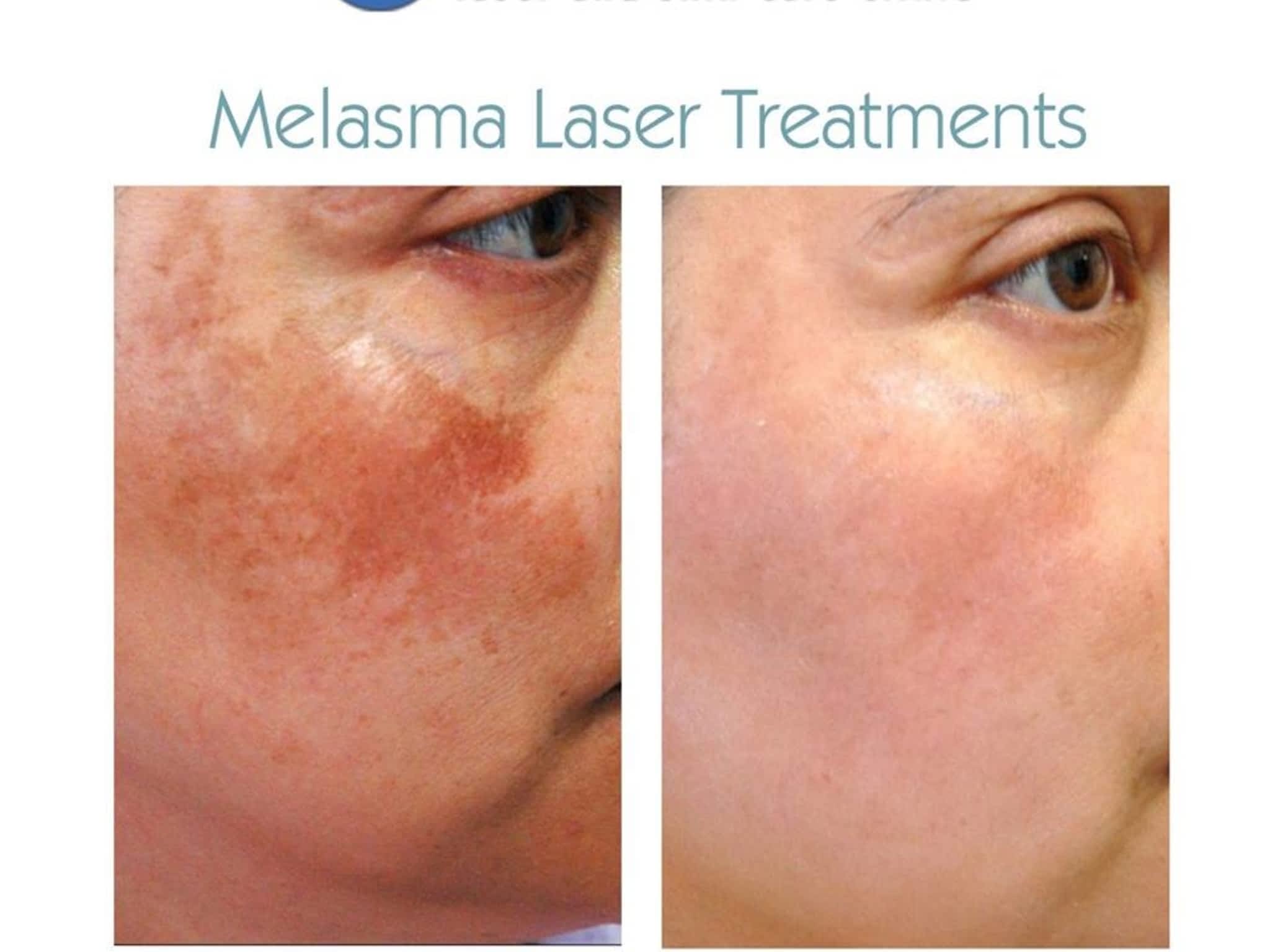 photo Enlighten Laser & Skin Care Clinic Calgary SW