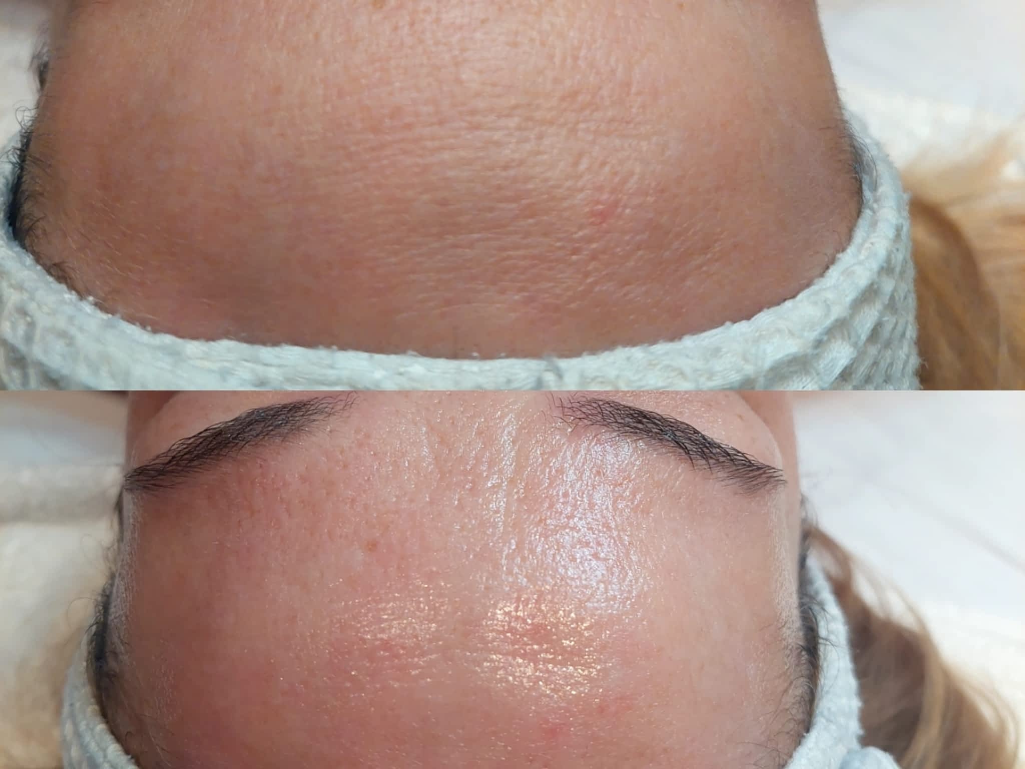 photo Clinique Beauté Médic - Soin du visage, Épilation laser Lévis