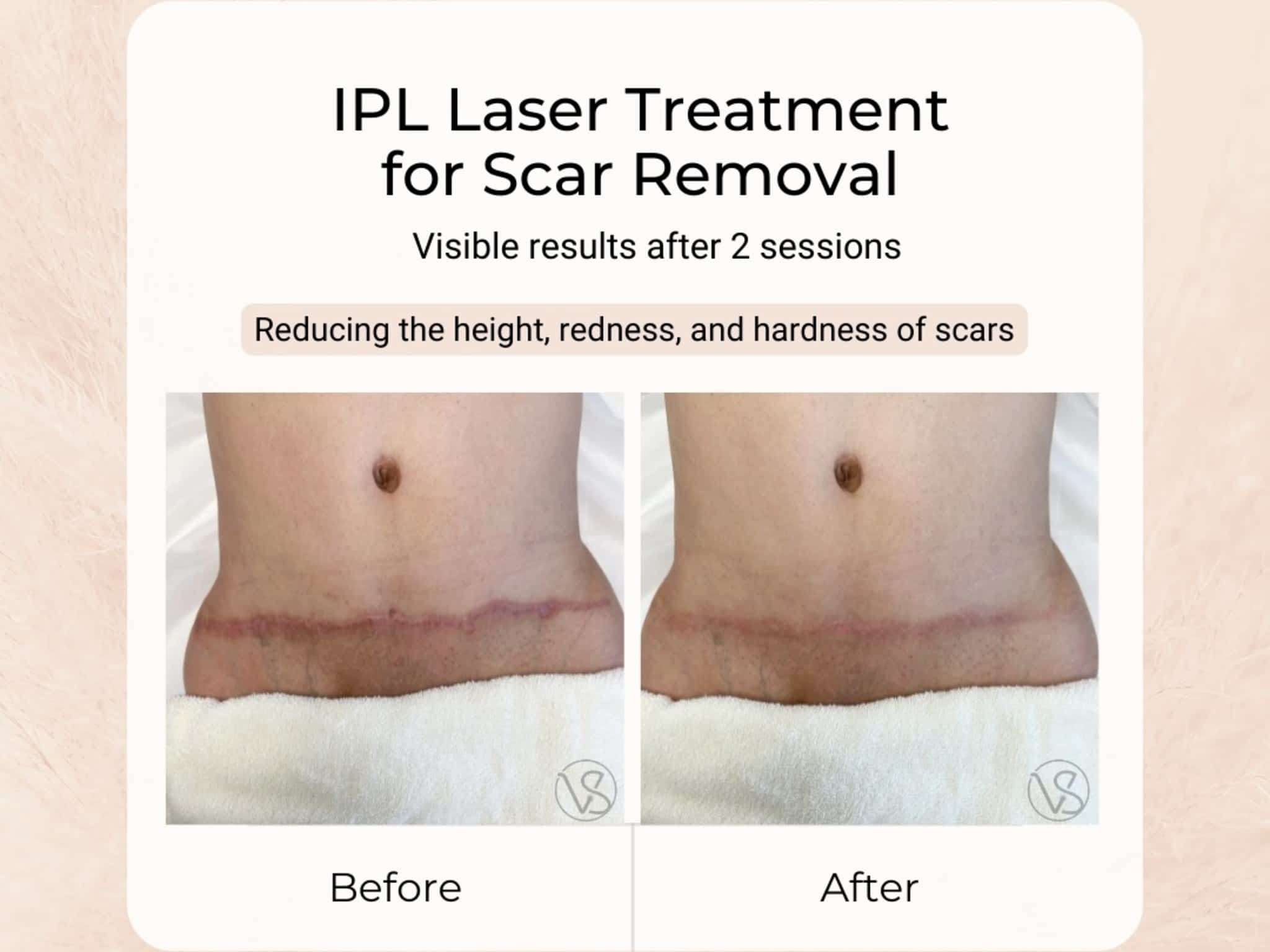 photo VS MedSpa Laser & Skin Clinic in Toronto