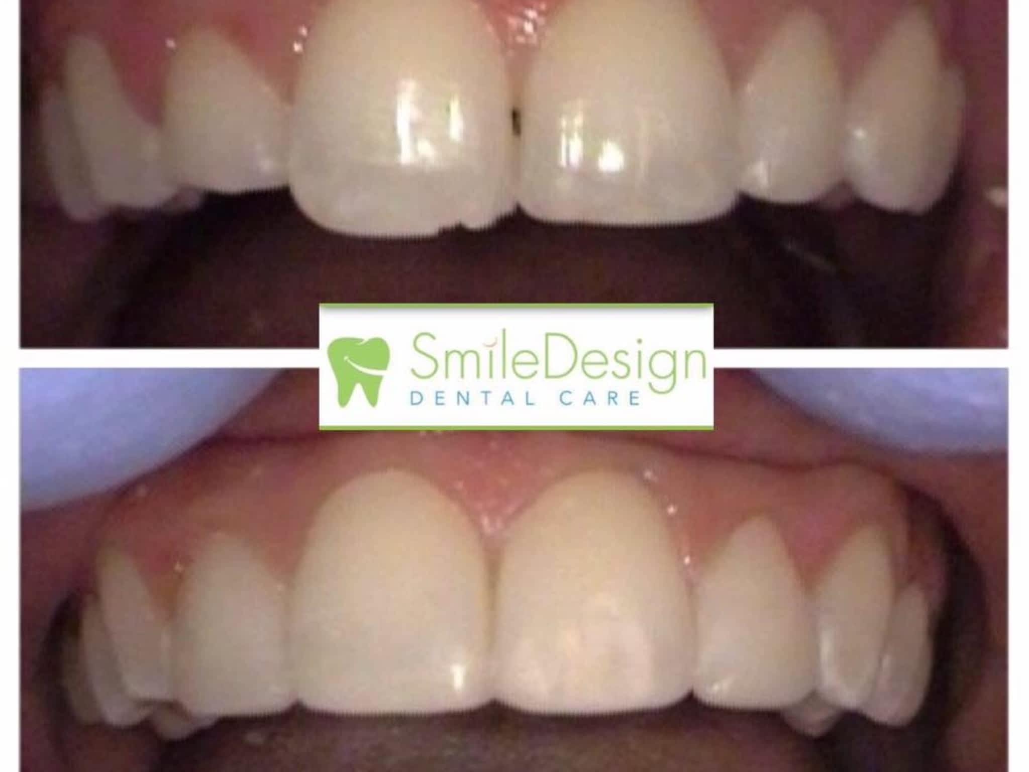 photo Smile Design Dental Care