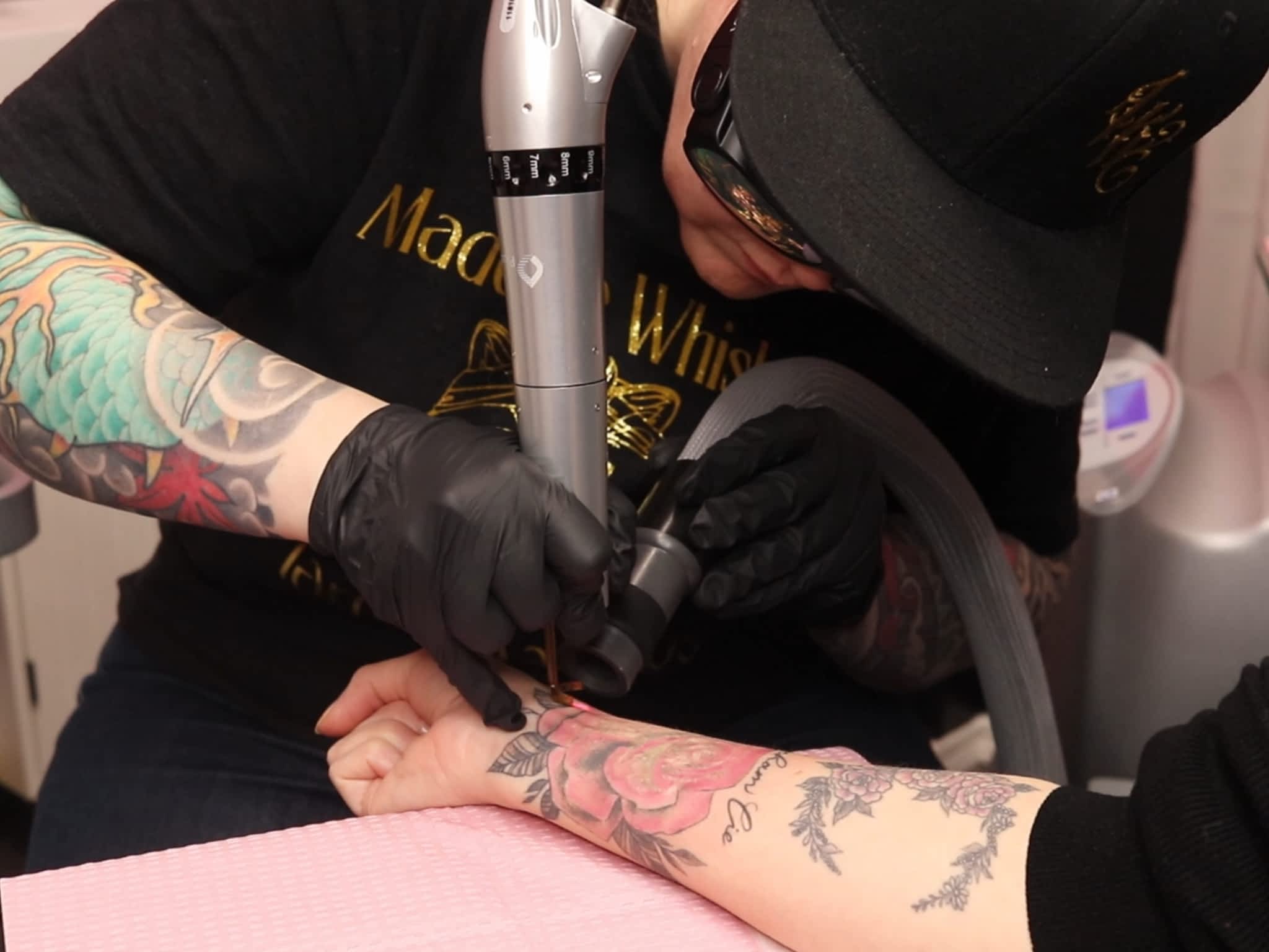 photo Legacy Tattoo Removal Limited